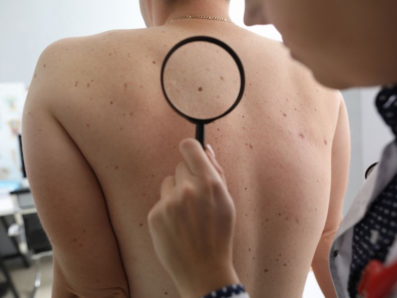 Dermatološka klinika diagnosticira in zdravi bolezni kože